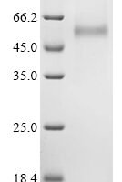 Hantaan virus Envelopment polyprotein (GP), partial Recombinant Protein, C-His, aa 649–1105, Mammalian cell - BioCrest Sci