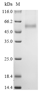 Hantaan virus Envelopment polyprotein (GP), partial Recombinant Protein, C-His, aa 649–1105, Mammalian cell, Hantaan virus (strain 76-118) (Korean hemorrhagic fever virus), Mammalian cell, C-terminal 6xHis-tagged, 52.7 kDa, purity >≥ 90% as determined by SDS-PAGE.