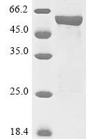 Arabidopsis thaliana UDP-glycosyltransferase 72B1 (UGT72B1) Recombinant Protein - BioCrest Sci