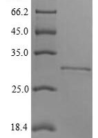 Rabbit Integrin beta-8 (ITGB8), partial Recombinant Protein, N-His-tagged/Tag-Free - BioCrest Sci