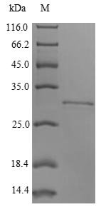 Rabbit Integrin beta-8 (ITGB8), partial Recombinant Protein, N-His-tagged/Tag-Free, Oryctolagus cuniculus (Rabbit), Yeast, N-terminal His-tagged/Tag-Free, 30.4 kDa, purity >≥ 90% as determined by SDS-PAGE.