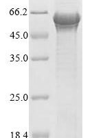 Human E3 ubiquitin-protein ligase TRAIP (TRAIP1) Recombinant Protein, C-His - BioCrest Sci