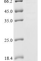 Streptococcus pneumoniae Penicillin-binding protein 2X (pbpX), partial,Biotinylated Recombinant Protein - BioCrest Sci