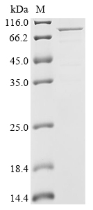 Streptococcus pneumoniae Penicillin-binding protein 2X (pbpX), partial,Biotinylated Recombinant Protein, Streptococcus pneumoniae (strain ATCC BAA-255 / R6), E.coli, N-terminal MBP-tagged and C-terminal 6xHis-Avi-tagged, 83.2 kDa, purity >≥ 85% as determined by SDS-PAGE.