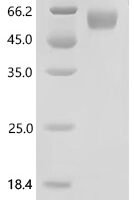 Mouse Plasmalemma vesicle-associated protein (Plvap), partial Recombinant Protein - BioCrest Sci