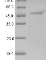 Human Regulator of G-protein signaling 10 (RGS10) Recombinant Protein - BioCrest Sci