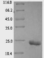 Leiurus quinquestriatus hebraeus Alpha-insect toxin LqhaIT Recombinant Protein - BioCrest Sci