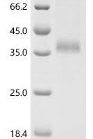 Human E3 ubiquitin-protein ligase MIB1 (MIB1), partial Recombinant Protein, C-10His - BioCrest Sci