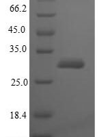 Streptomyces clavuligerus Beta-lactamase inhibitory protein Recombinant Protein - BioCrest Sci