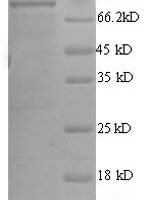 Escherichia coli ATP-dependent DNA helicase rep (rep) Recombinant Protein - BioCrest Sci