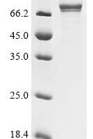 Human Lysine-specific demethylase RSBN1L (RSBN1L), partial Recombinant Protein - BioCrest Sci