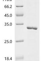 Human C-reactive protein (CRP) Recombinant Protein - BioCrest Sci