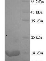 Apium graveolens Major allergen Api g 1, isoallergen 2 Recombinant Protein, N-His, aa 1–159, Yeast - BioCrest Sci