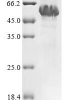 Human CUGBP Elav-like family member 1 (CELF1) Recombinant Protein - BioCrest Sci
