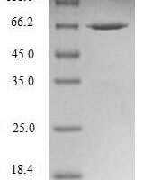Human Nuclear distribution protein nudE-like 1 (NDEL1) Recombinant Protein - BioCrest Sci