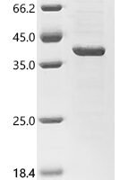 Human Prohibitin-2 (PHB2), partial Recombinant Protein, C-His - BioCrest Sci