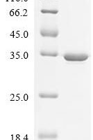 Mouse Dihydropteridine reductase (Qdpr) Recombinant Protein - BioCrest Sci