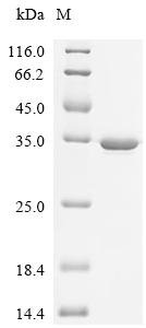 Mouse Dihydropteridine reductase (Qdpr) Recombinant Protein, Mus musculus (Mouse), E.coli, C-terminal 6xHis-tagged, 32.5 kDa, purity >≥ 95% as determined by SDS-PAGE.