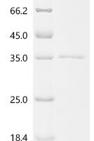 Human Granzyme K (GZMK) Recombinant Protein, C-His - BioCrest Sci