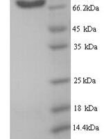 Human B-cell scaffold protein with ankyrin repeats (BANK1) Recombinant Protein - BioCrest Sci