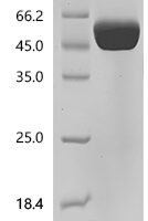 Mouse T-cell surface glycoprotein CD5 (Cd5), partial, Biotinylated Recombinant Protein - BioCrest Sci