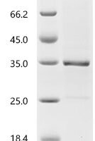 Mouse Granzyme A (Gzma) Recombinant Protein, C-His - BioCrest Sci