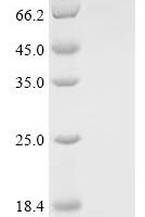 Mouse Fatty acid-binding protein, adipocyte (Fabp4) Recombinant Protein, C-His - BioCrest Sci