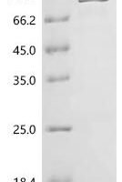 Human Disabled homolog 1 (DAB1) Recombinant Protein - BioCrest Sci