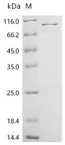 Human Disabled homolog 1 (DAB1) Recombinant Protein, Homo sapiens (Human), E.coli, C-terminal 6xHis-tagged, 70.7 kDa, purity >≥ 85% as determined by SDS-PAGE.