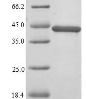 Human TAR DNA-binding protein 43 (TARDBP), partial Recombinant Protein, N-His - BioCrest Sci