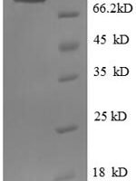 Human Endoplasmin (HSP90B1), partial Recombinant Protein - BioCrest Sci