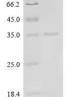 Human Vascular endothelial growth factor A (VEGFA) Recombinant Protein, N-His, aa 27–232, E.coli - BioCrest Sci