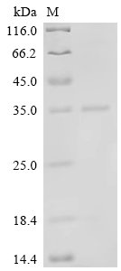 Human Vascular endothelial growth factor A (VEGFA) Recombinant Protein, N-His, aa 27–232, E.coli, Homo sapiens (Human), E.coli, N-terminal 6xHis-tagged, 30.8 kDa, purity >≥ 90% as determined by SDS-PAGE.