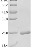 Mouse Amphiregulin (Areg), partial Recombinant Protein, C-His - BioCrest Sci