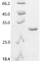 Human Amelogenin, X isoform(AMELX) Recombinant Protein - BioCrest Sci