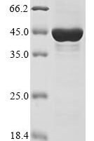 Human Inactive histone-lysine N-methyltransferase 2E (KMT2E), partial Recombinant Protein - BioCrest Sci