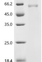 Rat Keratin, type I cytoskeletal 18 (Krt18), partial Recombinant Protein - BioCrest Sci