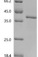 Human Matrix metalloproteinase-14 (MMP14), partial Recombinant Protein - BioCrest Sci