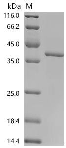 Human Matrix metalloproteinase-14 (MMP14), partial Recombinant Protein, Homo sapiens (Human), E.coli, C-terminal 10xHis-tagged, 37.1 kDa, purity >≥ 95% as determined by SDS-PAGE.