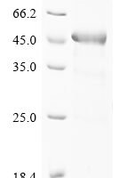 Human A disintegrin and metalloproteinase with thrombospondin motifs 18 (ADAMTS18), partial Recombinant Protein, N-10His-GST/C-Myc - BioCrest Sci