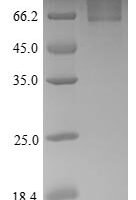 Human Gamma-1-syntrophin (SNTG1) Recombinant Protein - BioCrest Sci