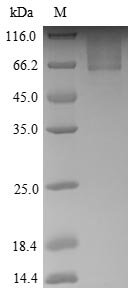 Human Gamma-1-syntrophin (SNTG1) Recombinant Protein, Homo sapiens (Human), Yeast, N-terminal 6xHis-tagged and C-terminal Myc-tagged, 61.5 kDa, purity >≥ 90% as determined by SDS-PAGE.