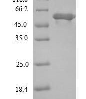 Escherichia coli Lipoate-protein ligase A (lplA) Recombinant Protein - BioCrest Sci
