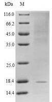 Human Glucagon-like peptide 1 receptor (GLP1R), partial Recombinant Protein, N-His - BioCrest Sci