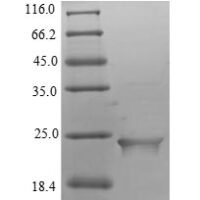 Human Putative inactive neutral ceramidase B (ASAH2B) Recombinant Protein, N-His, aa 1–165, E.coli - BioCrest Sci