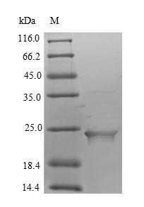Human Putative inactive neutral ceramidase B (ASAH2B) Recombinant Protein, N-His, aa 1–165, E.coli, Homo sapiens (Human), E.coli, N-terminal 6xHis-tagged, 23.0 kDa, purity >≥ 90% as determined by SDS-PAGE.