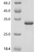 Human Tolloid-like protein 1 (TLL1), partial Recombinant Protein - BioCrest Sci