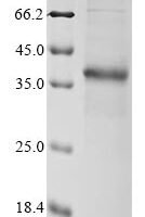 Anemonia sulcata GFP-like non-fluorescent chromoprotein FP595 Recombinant Protein, C-hFc1 - BioCrest Sci