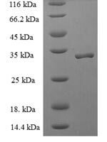 Human Signal recognition particle 19 kDa protein (SRP19) Recombinant Protein - BioCrest Sci