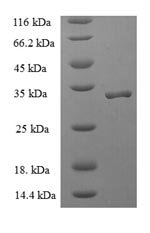 Human Signal recognition particle 19 kDa protein (SRP19) Recombinant Protein, Homo sapiens (Human), E.coli, N-terminal 6xHis-SUMO-tagged, 32.0 kDa, purity >≥ 90% as determined by SDS-PAGE.